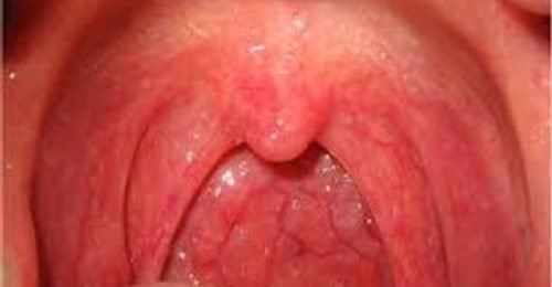 910504_278c2f927fb54d18a307619bb