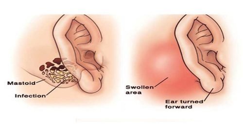 910504_469375a137f541e69d1711fdf