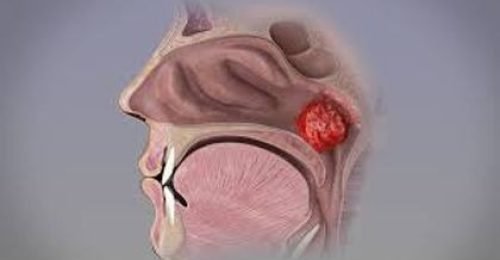 910504_5718c9345ff3435fbb2422d4b