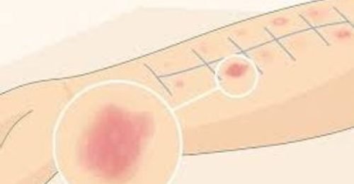 910504_f0114c387c134e78b225e69ce